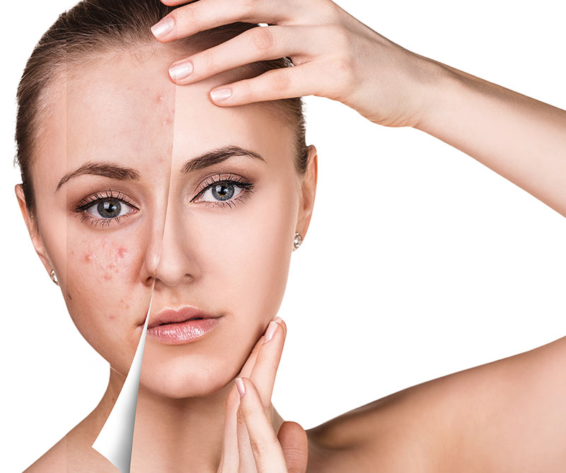 Deep Cleansing Facial-1c